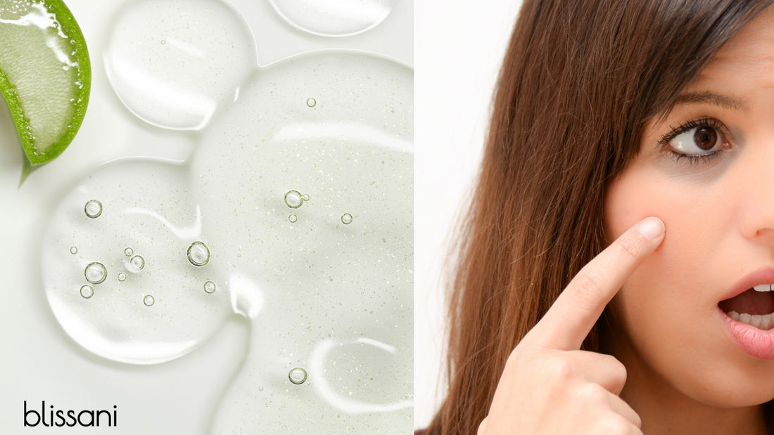a piece of cut aloe and some gel on a white counter next to a woman touching her dark under eye circle