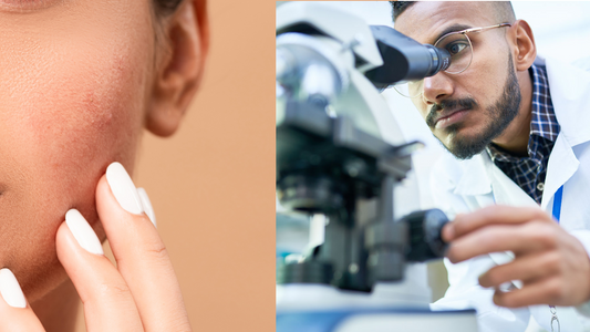 woman with acne next to a doctor looking into a microsope