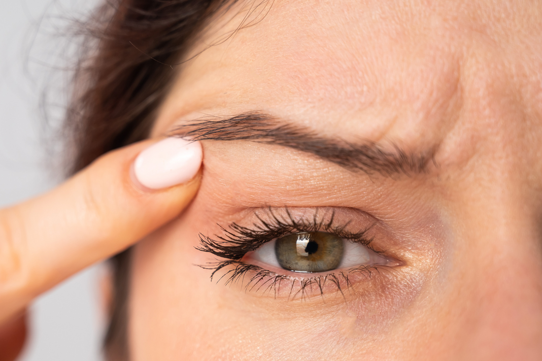 a woman holding her finger to her eye wrinkles