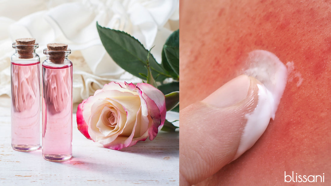 two bottles of rose water next to a pink and white rose next to a person placing cream on an irritated blemish