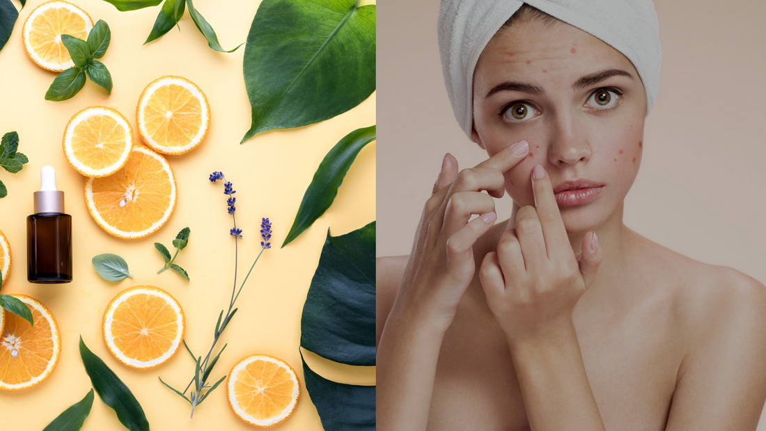 natural ingredients next to a woman examining acne on her face