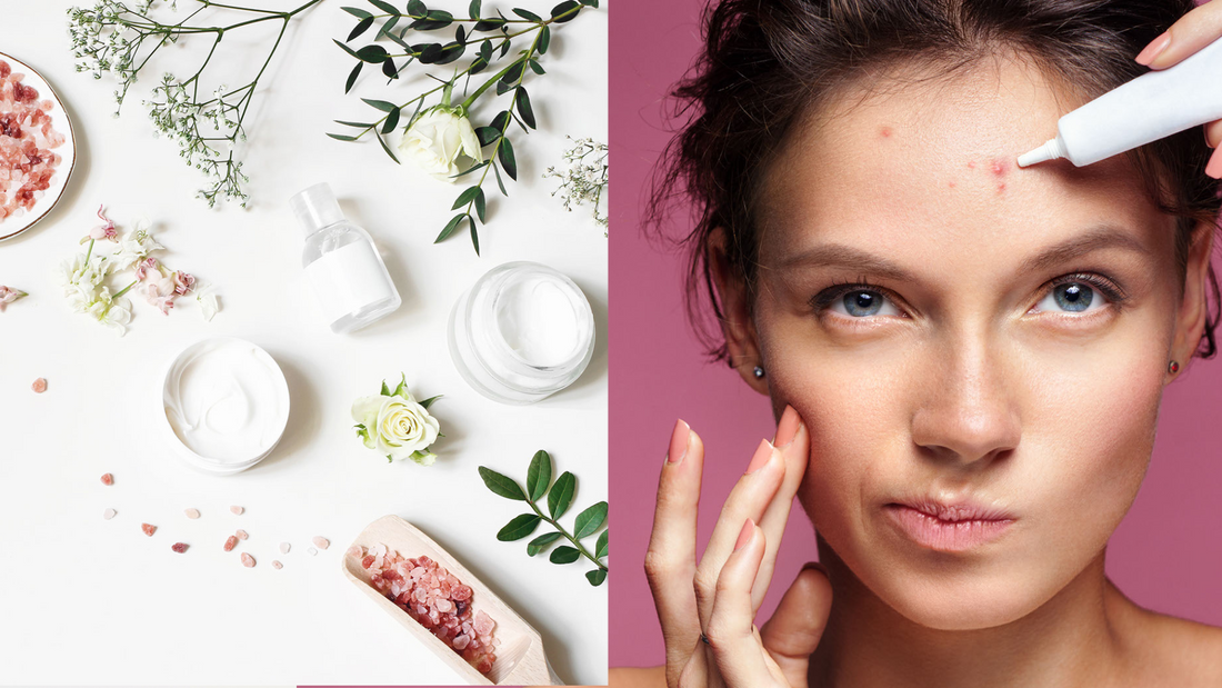 a woman applying acne spot treatment to her forehead next to a variety of natural ingredients for skin and acne