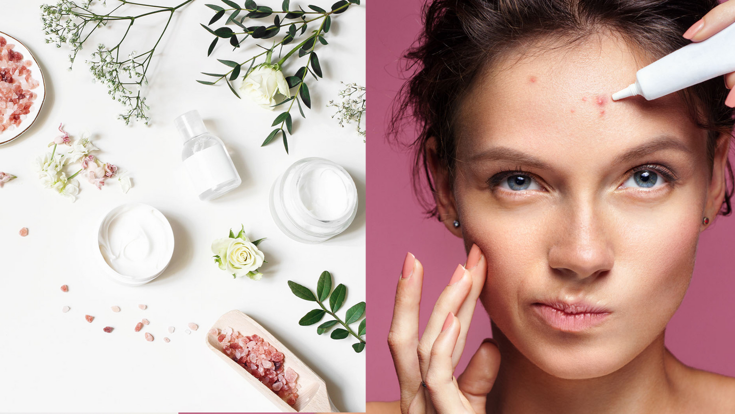 5-best-natural-ingredients-to-treat-acne-diy-spot-treatment-recipes