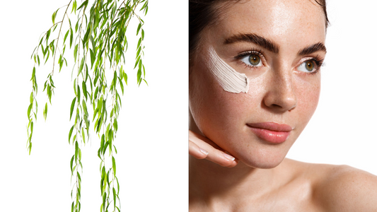 White Willow Branch and a woman with natural acne cream on her face